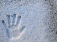 Dry Hands and nails